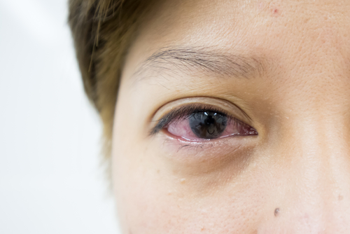 What Are The Symptoms Of Carpet Allergy?